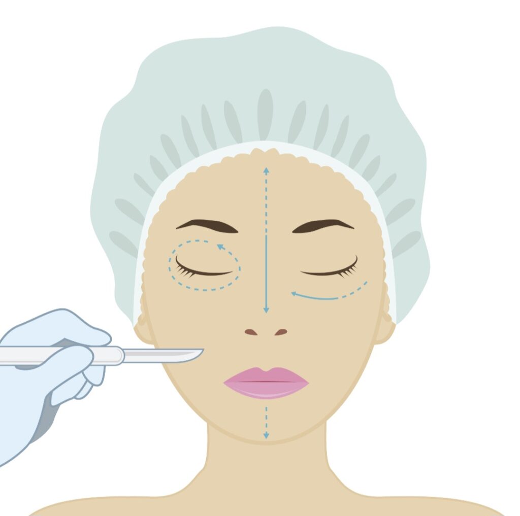 Is Dermaplaning Safe for You? 